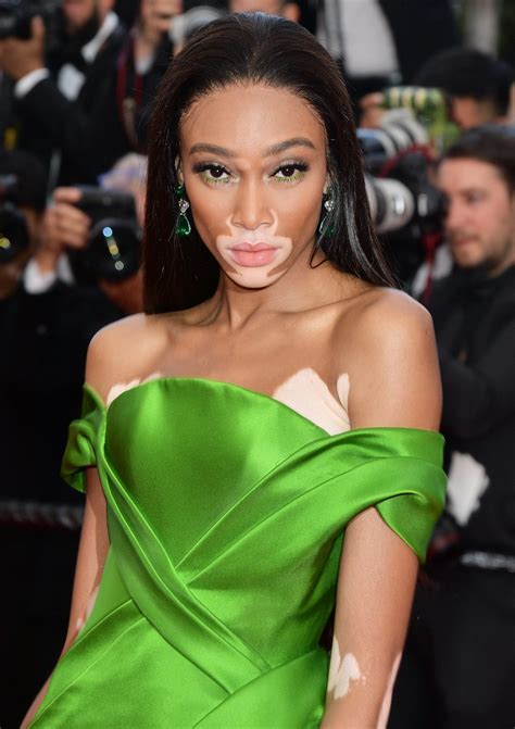 winnie harlow net worth|Here’s How Much Supermodel Winnie Harlow Is Worth Today